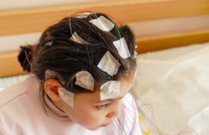 kleines Mädchen mit EEG-Elektroden am Kopf